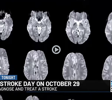World Stroke Day on Oct. 29